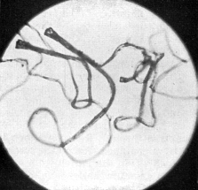 Loriform hairs from the indumentum of R. bullatum