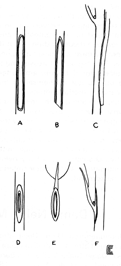 Grafting diagrams