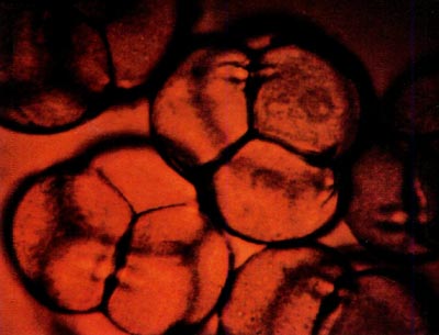 photomicrograph showing portions of five tetrads