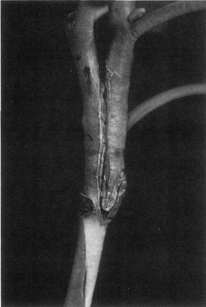 Figure 7. Unwrapped side graft.