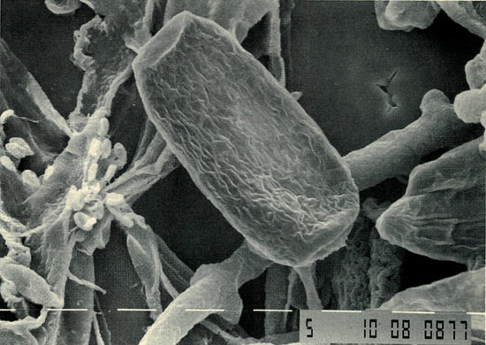 Figure 1. Conidium (asexual spore) of
Oidium on R. sessilifolium.