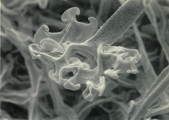 Figure 3. Mature cleistothecial appendage of
Microsphaera azaleaeon R. mekongense.