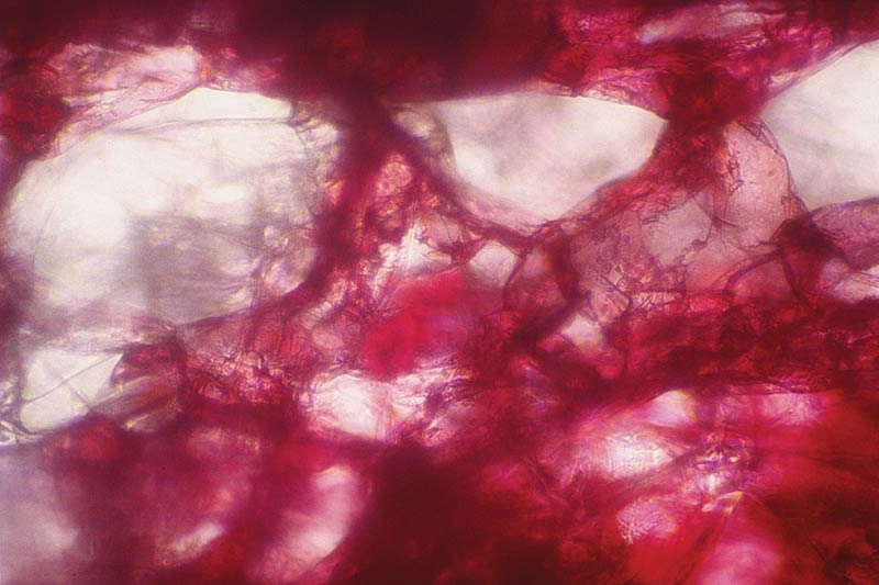 Fig. 5. Cross section showing lacunae
(large air spaces) in the spongy mesophyll tissue